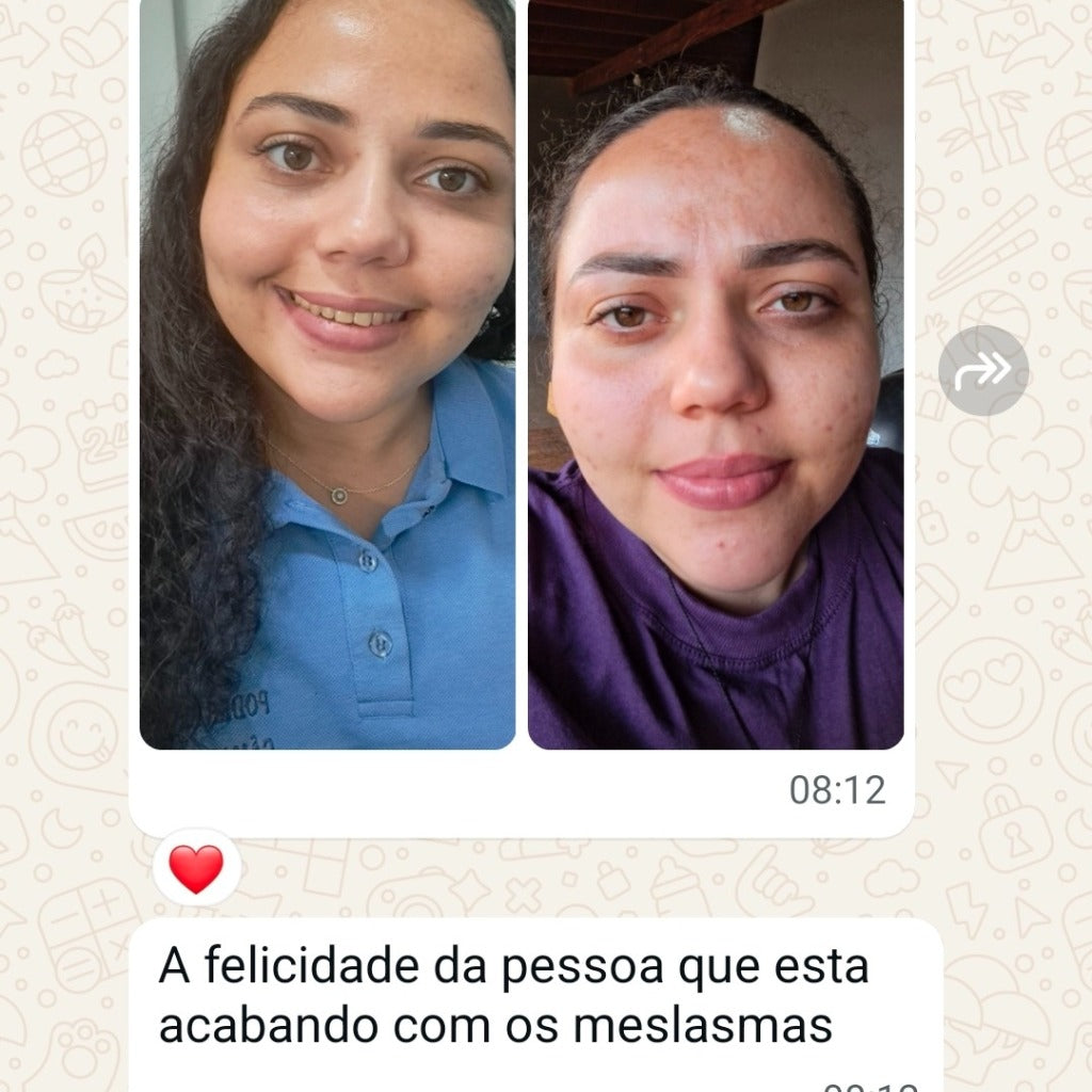 Kit 100Melasma + Protocolo Contra Melasma (Ebook grátis)