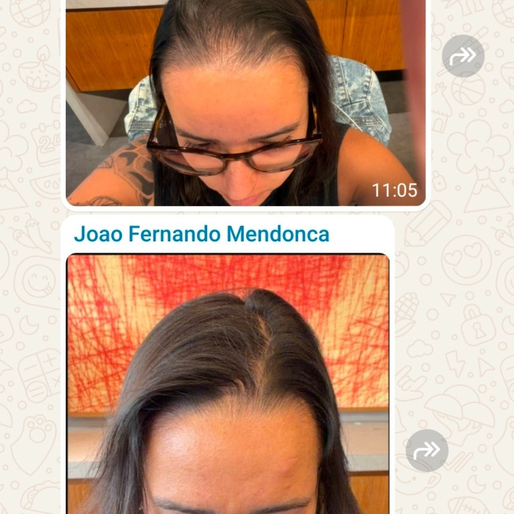 Tônico 100queda 150mL + Ebook Grátis